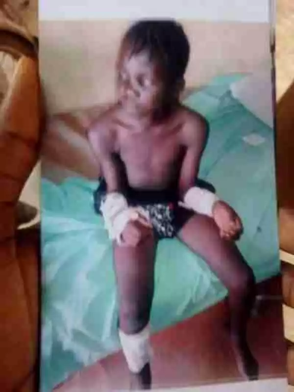 Wickedness:- See The Girl Mutilated With Razor Blade By Her Step Mother ( Graphic Photos)